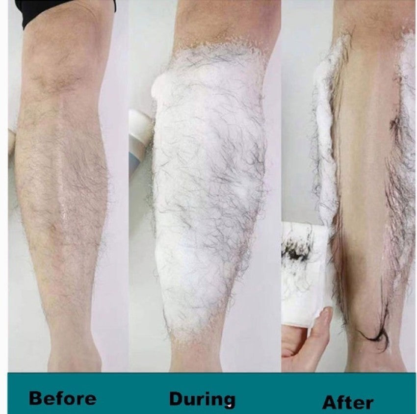 Ecrin Hair Removal Body Spray(Remove Hair In 3 Mins)